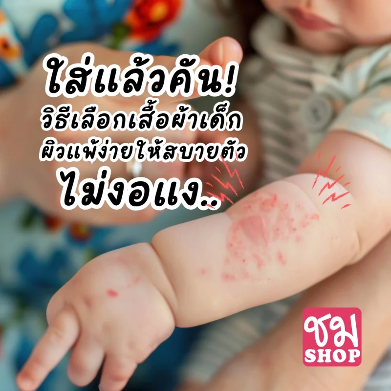 เสื้อผ้าเด็กผิวแพ้ง่าย